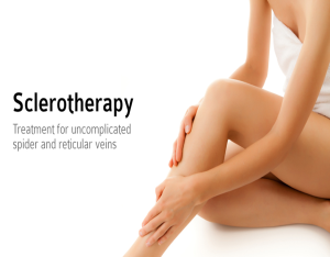 sclerotherapy 2